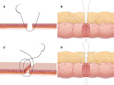 An alternative asymmetric figure-of-eight single-layer suture technique for bowel anastomosis in an in vitro porcine model